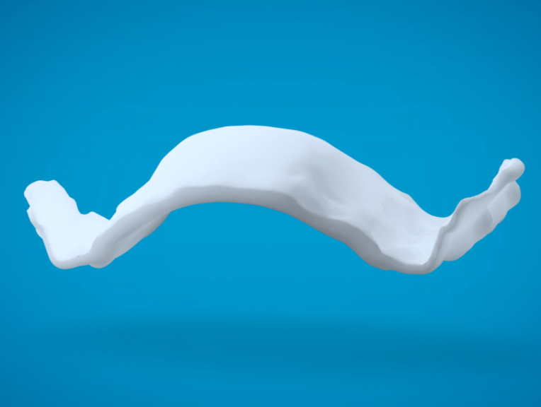 Invisalign IPE