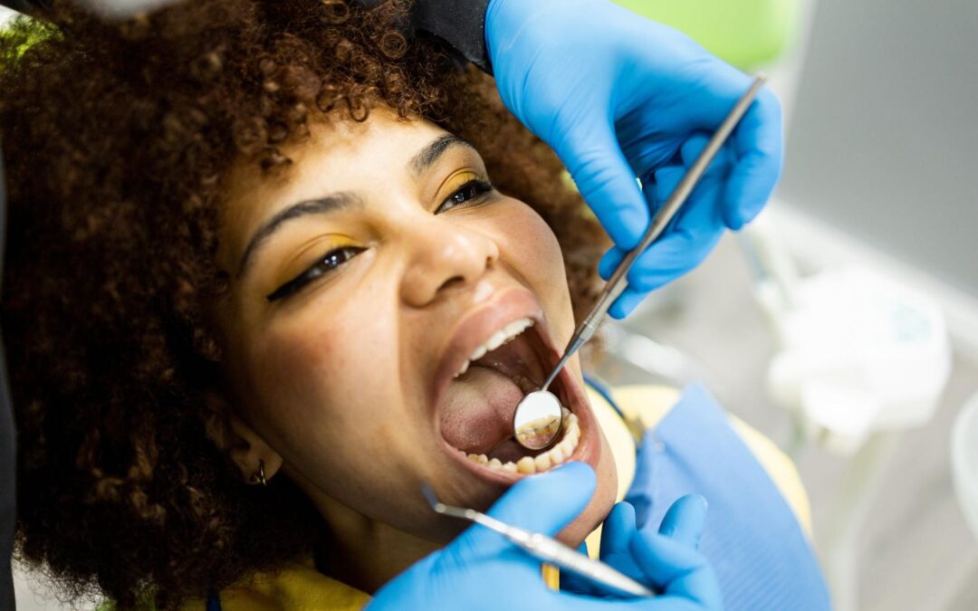 Do I Need a Bonded Retainer After Braces?