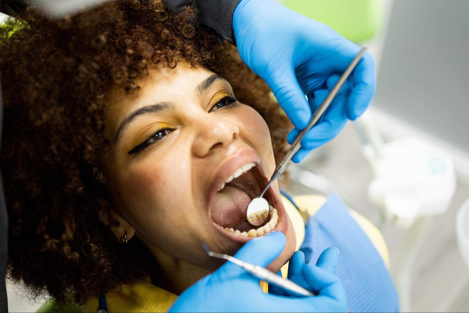 Do I Need a Bonded Retainer After Braces?