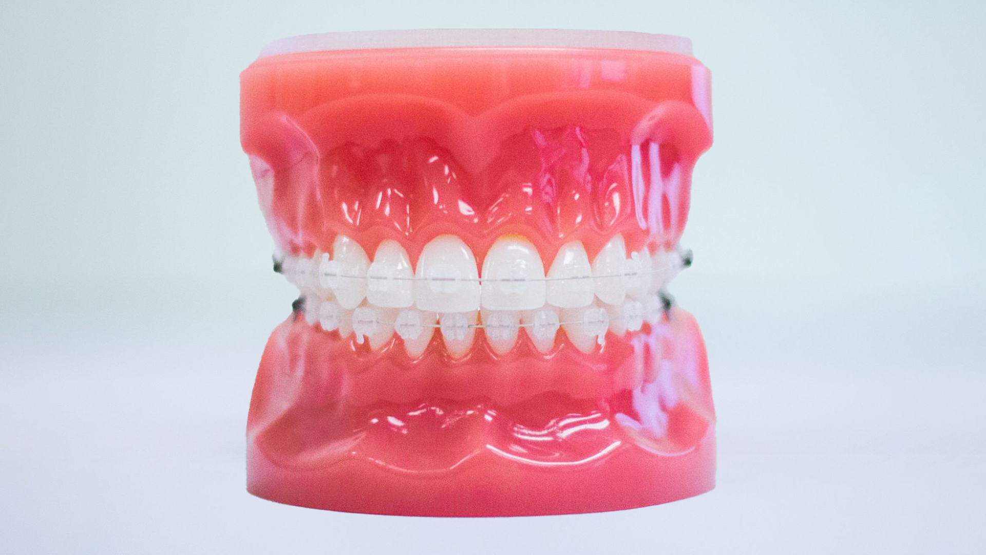 minnetonka orthodontics