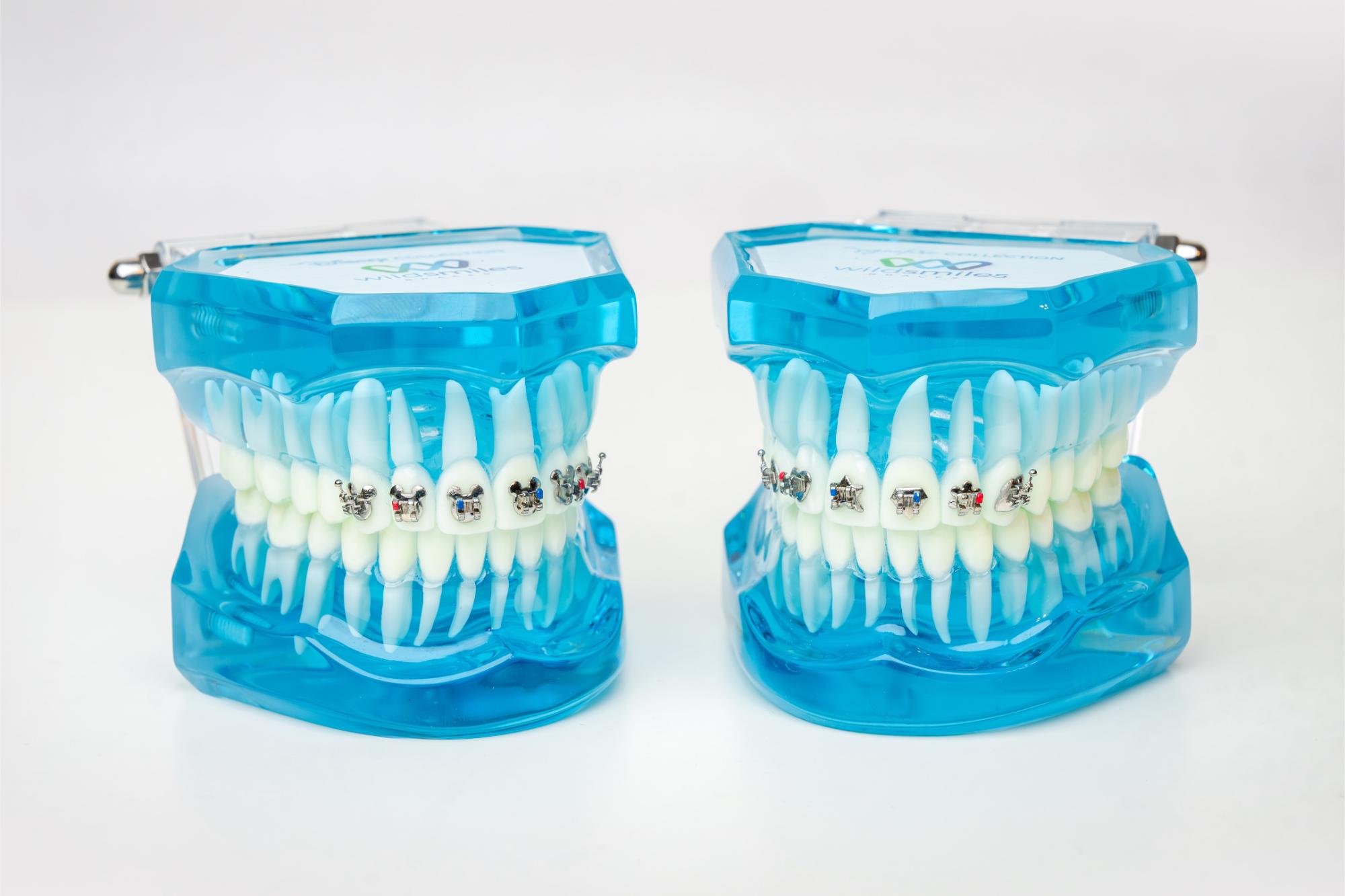 orthodontist minnetonka