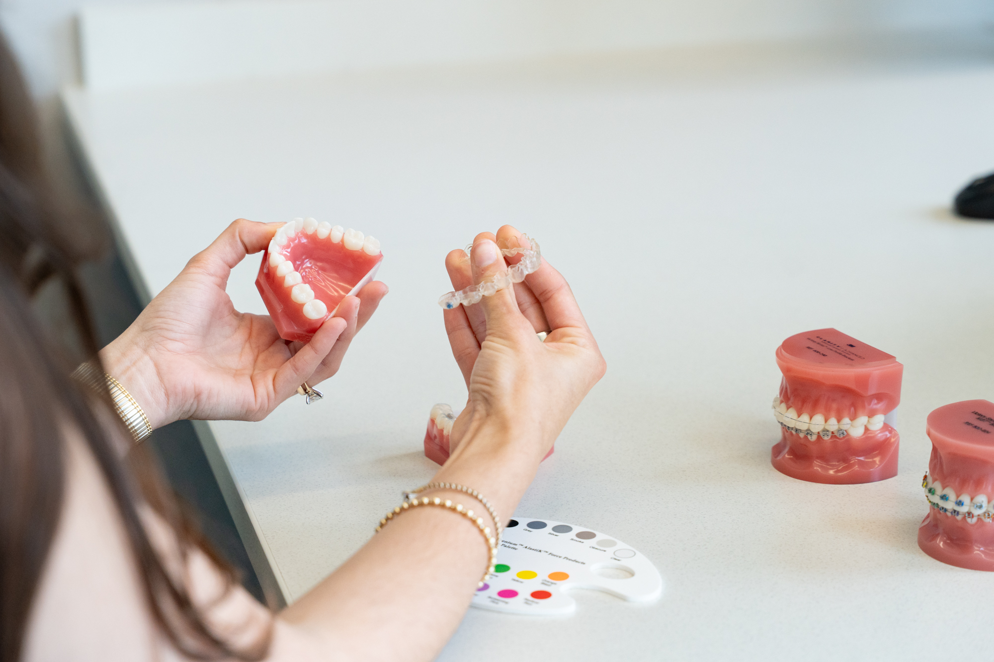 Dental model showing braces at Ovation Orthodontics