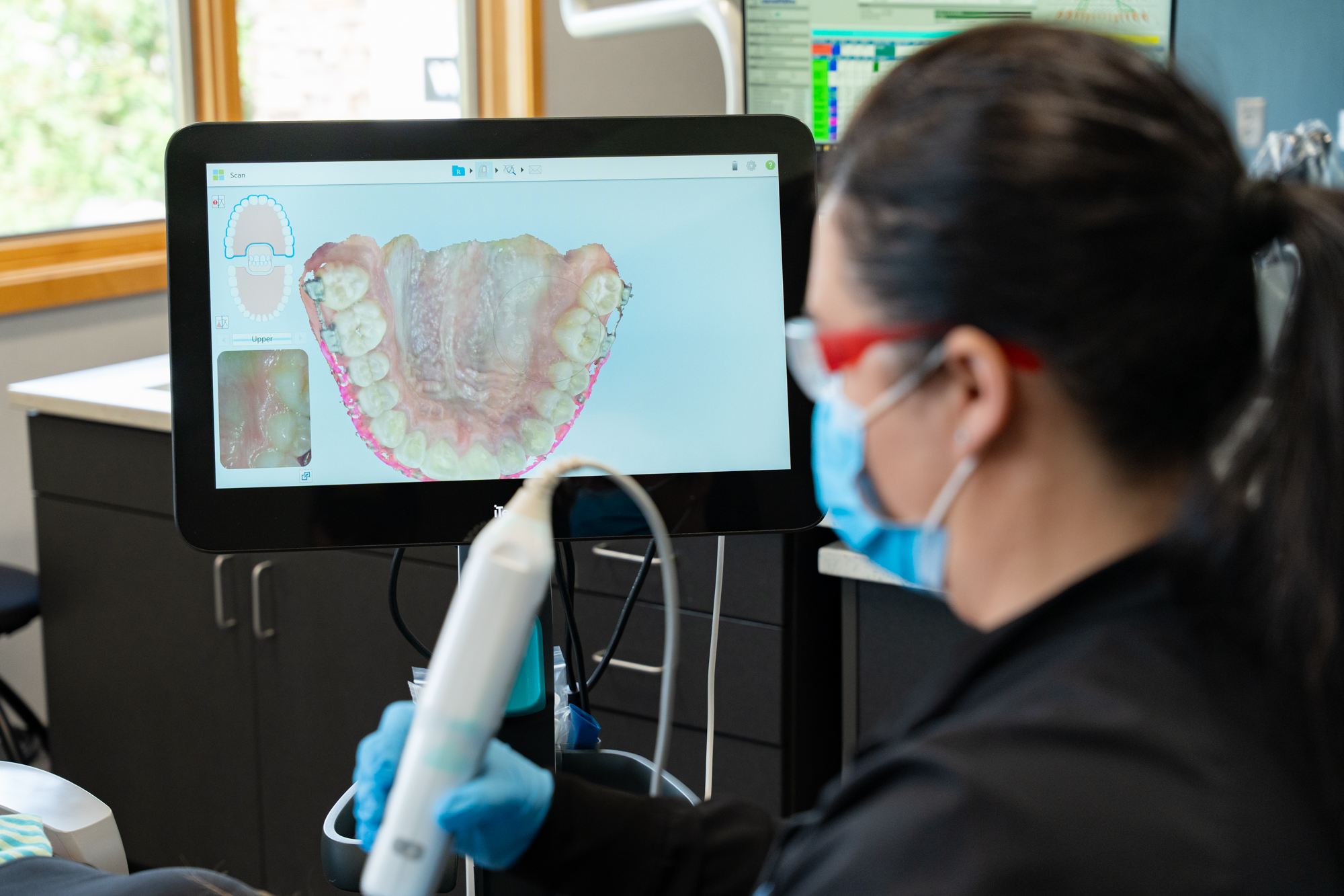 Digital orthodontic scans