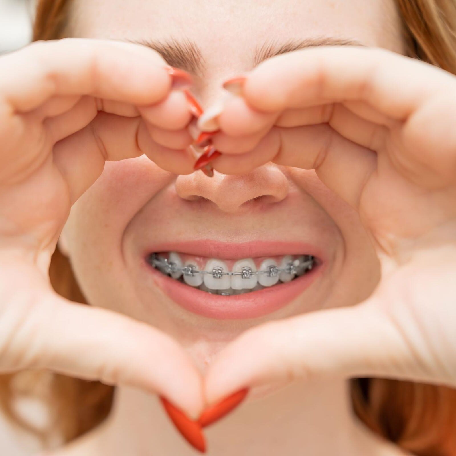 How Much Does Orthodontic Treatment Cost?